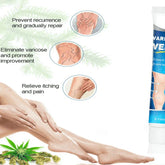 Varicose Vein Treatment Relief Cream